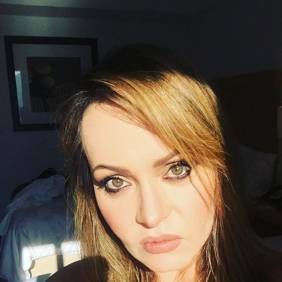 Gaby Spanic passou a apostar em procedimentos estéticos para garantir o rejuvenescimento