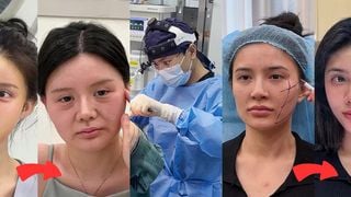 Facelift milagroso: os antes e depois das cirurgias plásticas deste médico chinês vão ter fazer ficar de queixo caído