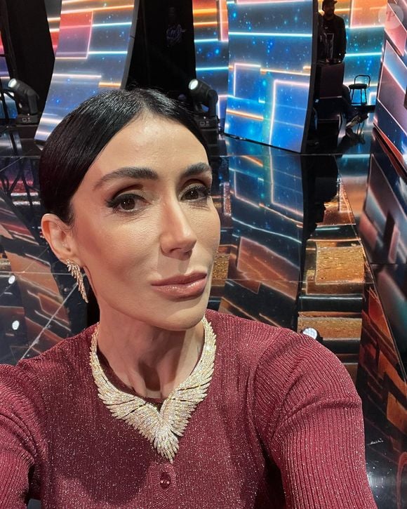 Além dos preenchedores, o botox ajudou Michelle Barros a manter sua aparência rejuvenescida