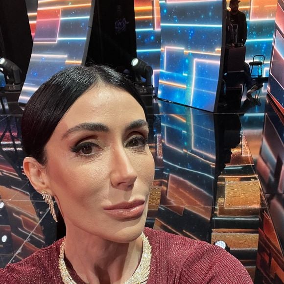 Além dos preenchedores, o botox ajudou Michelle Barros a manter sua aparência rejuvenescida