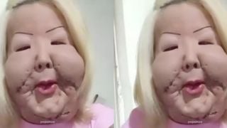 Juju do Pix aparece pela 1ª vez após cirurgia no rosto, exibe resultado e divide opiniões na web: 'Não é possível que tenha ficado assim'