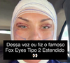 Andressa Urach também destacou os olhos com pontos após a cirurgia e garantiu que o resultado final ainda não está pronto