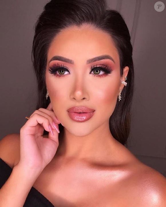 Jordana fez rinoplastia, implante de silicone, lipoaspiração, botox e harmonização facial