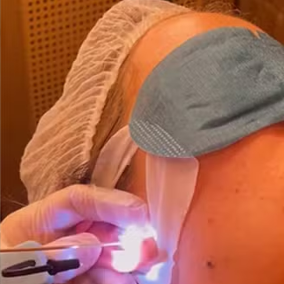 Um spa de orelhas, geralmente, oferece higienização profunda, hidratação, limpeza de impurezas, massagens areoculares e cuidados com piercing, brincos e demais joias