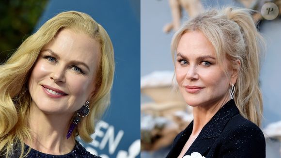 Já Nicole Kidman não abusa do botox e usa apenas para melhorar sua aparência
