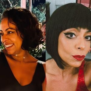 Samantha Schmütz antes e depois: veja a transformação da atriz desde a 'Zorra Total' até os procedimentos recentes com médico de Kim Kardashian