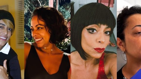 A transformação de Samantha Schmütz: atriz impressiona com novo visual após procedimento com médico de Kim Kardashian; veja 27 fotos do antes e depois!