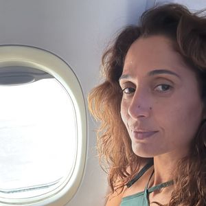 Como alternativa, Camila Pitanga é adepta de procedimentos com estimulação de colágeno
