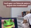 Fotos da cirurgia íntima de Lica Lopes são reais? Imagens de antes e depois circularam na web