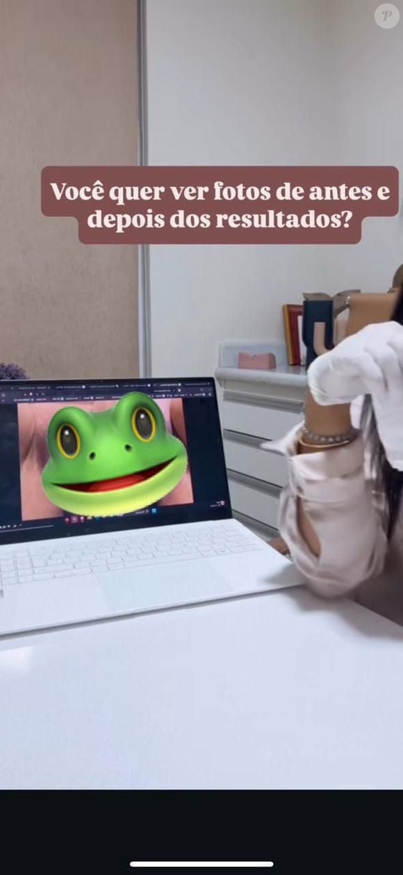 Fotos da cirurgia íntima de Lica Lopes são reais? Imagens de antes e depois circularam na web