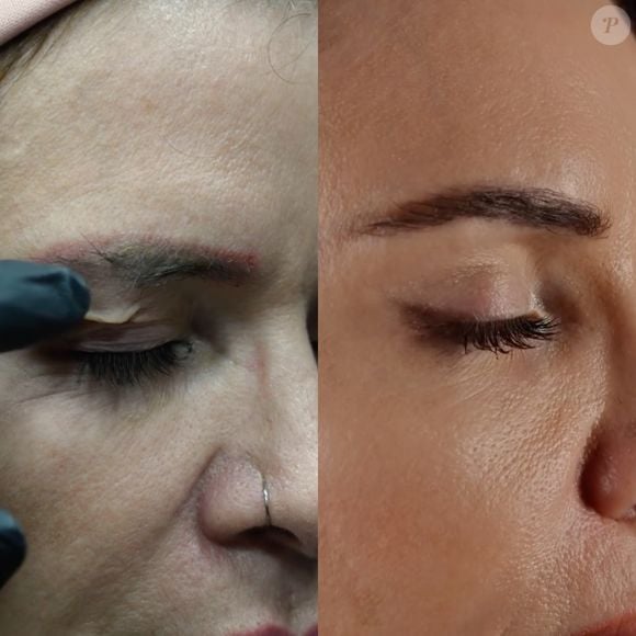 Além do facelift, a mãe de Viih Tube também fez uma blefaroplastia