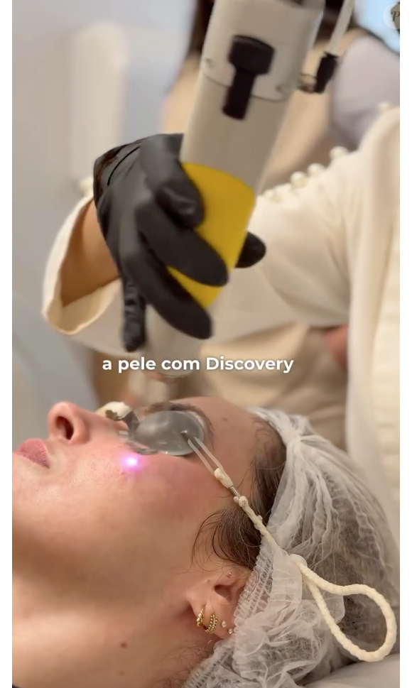 "Começamos a fazer o protocolo de Fotona 4D, que trata todas as dimensões da pele e também melhora o viço, as rugas finas e os poros dilatados", disse a dermatologista de Ana Paula