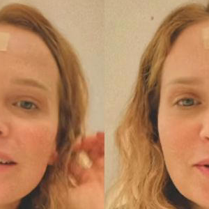Fernanda Rodrigues retira carcinoma, mostra curativo e deixa alerta aos fãs: 'Fiquem atentos aos sinais, manchas, pintas...'