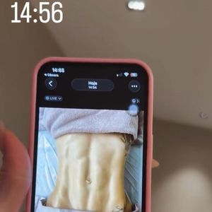 Virgínia Fonseca mostrou o antes e depois do corpo após uma sessão de drenagem linfática