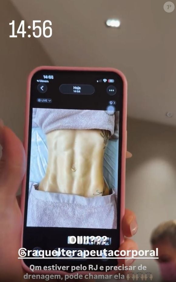 Virgínia Fonseca mostrou o antes e depois do corpo após uma sessão de drenagem linfática