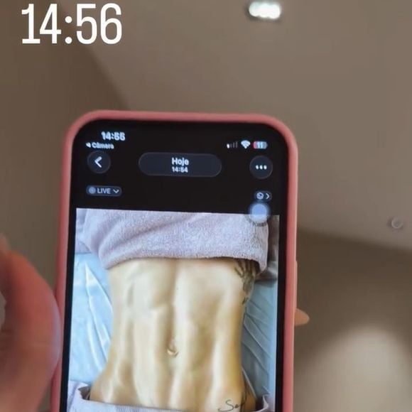 Virgínia Fonseca mostrou o antes e depois do corpo após uma sessão de drenagem linfática