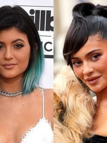 Kylie Jenner antes e depois do preenchimento labial: da 'boquinha' ao 'bocão', influenciadora transformou os lábios e ficou irreconhecível. Veja 28 fotos!
