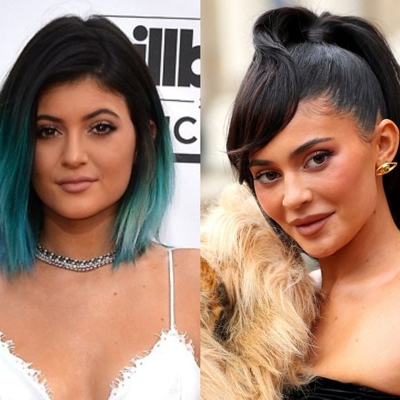 Kylie Jenner antes e depois: veja 28 fotos da transformação da influenciadora após o preenchimento labial
