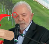 Coincidência: Lula também retirou um nevo melanocítico em abril e apareceu com curativo no rosto