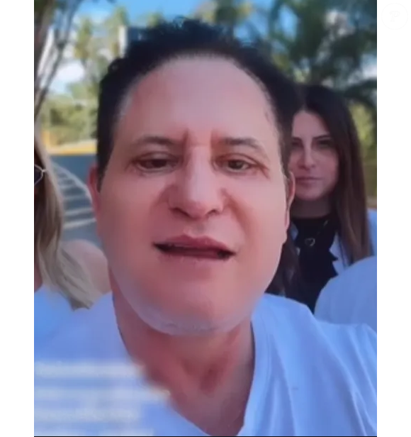 Resultado da harmonização facial de Marrone não agradou e virou piada na web