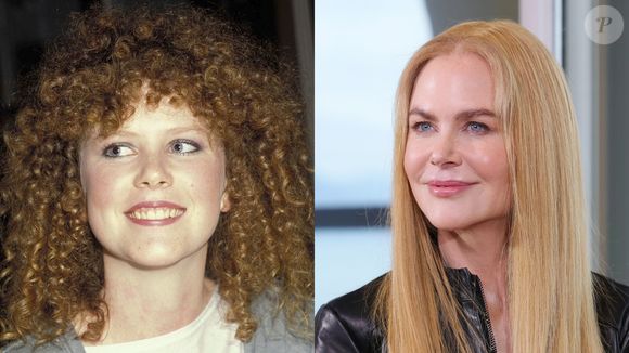 Antes e depois de Nicole Kidman: dá para acreditar que é a mesma pessoa? Atriz mudou da água para o vinho
