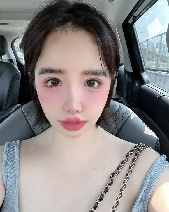 Mas foram justamente os olhos, vermelhos como neste clique, que acenderam o alerta para Park Bom