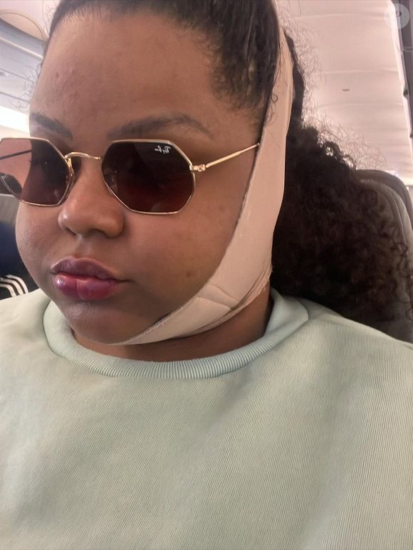 MC Carol de Niterói mostra resultado de lipo na papada após perder quase 70 kg