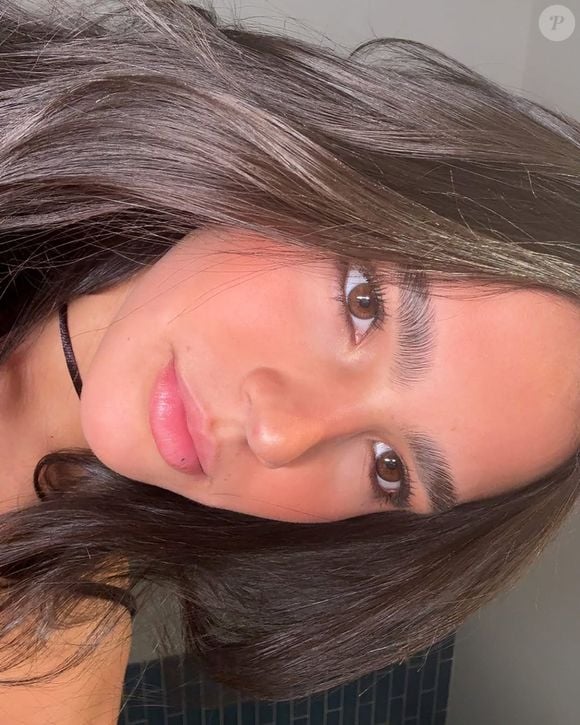 Doença de Duda Guerra, a hiperidrose é uma condição que leva à produção excessiva de suor, além do necessário para regular a temperatura corporal