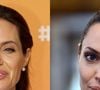 Angelina Jolie aplica a toxina botulínica nas maçãs do rosto, testa e região dos olhos