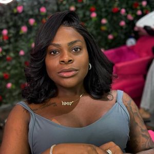 A cantora, de 28 anos, revelou que fará uma alectomia, procedimento indicado para afinar discretamente a região nasal.