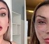 Antes e depois de Andressa Urach: influenciadora divide opiniões com 'resultado' de plástica de R$ 100 mil. 'Assusta de um jeito bom'