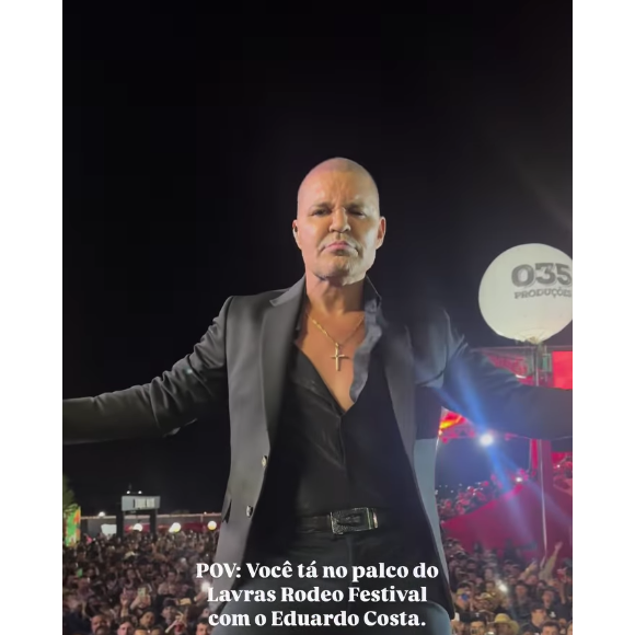 Eduardo Costa chocou todo mundo ao aparecer completamente careca durante um show nos últimos dias