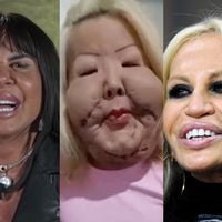 Caso Juju do Pix: além da influencer, outras 17 famosas já exageraram em procedimentos e ficaram com rosto completamente diferente