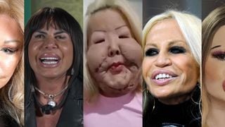 Caso Juju do Pix: além da influencer, outras 17 famosas já exageraram em procedimentos e ficaram com rosto completamente diferente