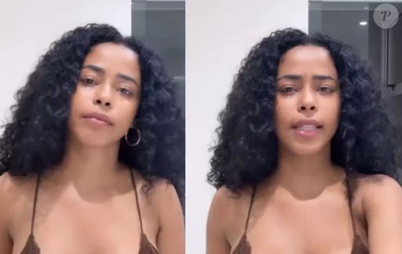 Lorena Maria é diagnosticada com vitiligo emocional