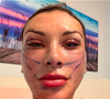 Neste sábado (09), Andressa Urach exibiu para seus seguidores como estava seu rosto apenas um dia após a cirurgia