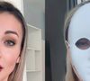 Andressa Urach antes e depois: influenciadora gasta R$ 100 mil em nova cirurgia plástica e choca a web. 'Vou voltar a ter 23 anos'