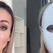Rosto irreconhecível e orelhas menores: Andressa Urach gasta R$ 100 mil em nova plástica e choca com antes e depois. 'Vou voltar a ter 23 anos'