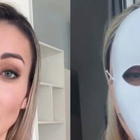 Rosto irreconhecível e orelhas menores: Andressa Urach gasta R$ 100 mil em nova plástica e choca com antes e depois. 'Vou voltar a ter 23 anos'