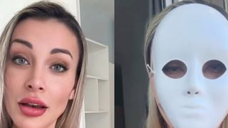 Rosto irreconhecível e orelhas menores: Andressa Urach gasta R$ 100 mil em nova plástica e choca com antes e depois. 'Vou voltar a ter 23 anos'