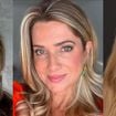 Blefaroplastia antes e depois: Luana Piovani, Letícia Spiller e mais famosas rejuvenesceram com cirurgia nas pálpebras; veja fotos!