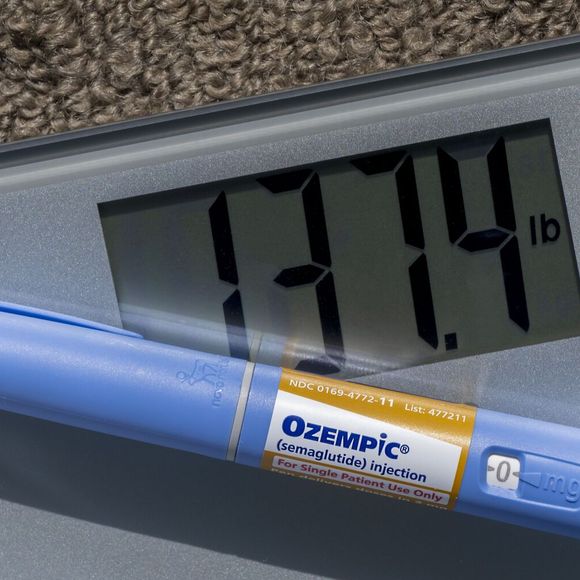 Ozempic para emagrecer: médica alerta para risco de queda de cabelo. 'Quem usa doses mais altas desses medicamentos sem a devida supervisão médica e acompanhamento nutricional tem maior risco de queda de cabelo'