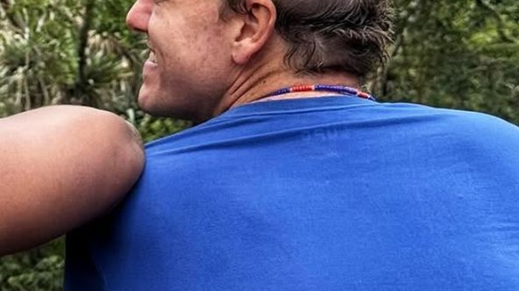 Remissão! Ator da Globo, Pablo Sanábio celebra fim do tratamento contra o câncer: 'Celebro a VIDA em letras maiúsculas'