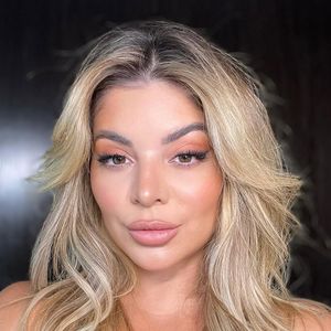 Transformações no rosto de Gkay começaram sutis, com harmonização e preenchimentos