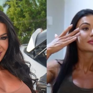 Gracyanne Barbosa antes e depois: ex-BBB retira preenchimentos do rosto, aposta em procedimentos tecnológicos e é confundida com Kim Kardashian