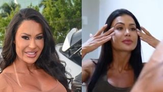 Gracyanne Barbosa antes e depois: ex-BBB é confundida com Kim Kardashian após retirar preenchimentos do rosto e apostar em procedimentos tecnológicos