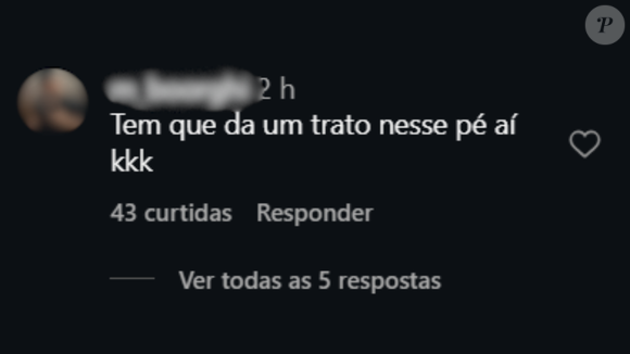 “Tem que da um trato nesse pé aí kkk”, escreveu um usuário. Outro comentou com emojis de risada: “verdade”