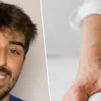 Pedro Azañón, fisioterapeuta: 'A osteoartrite do joelho é um processo degenerativo natural e a dor pode ser causada por inflamação, inatividade ou outros fatores relacionados ao estilo de vida'