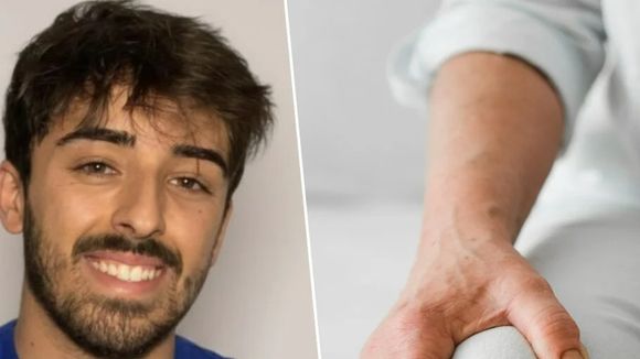 Pedro Azañón, fisioterapeuta: 'A osteoartrite do joelho é um processo degenerativo natural e a dor pode ser causada por inflamação, inatividade ou outros fatores relacionados ao estilo de vida'