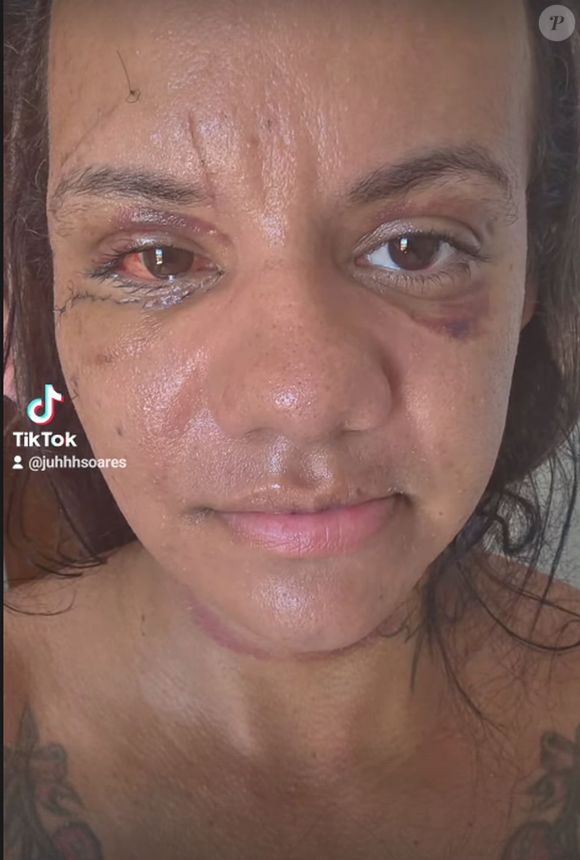 Juliana Soares contou ter sido ameaçada novamente, pela internet, mesmo após a agressão